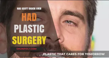 Scott Disick's Transformation: Plastic Surgery Rumors Explored and Debunked