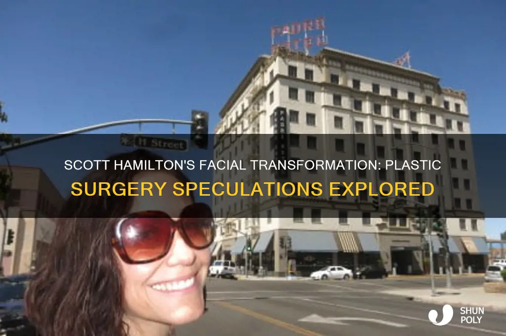 has scott hamilton had facial plastic surgery