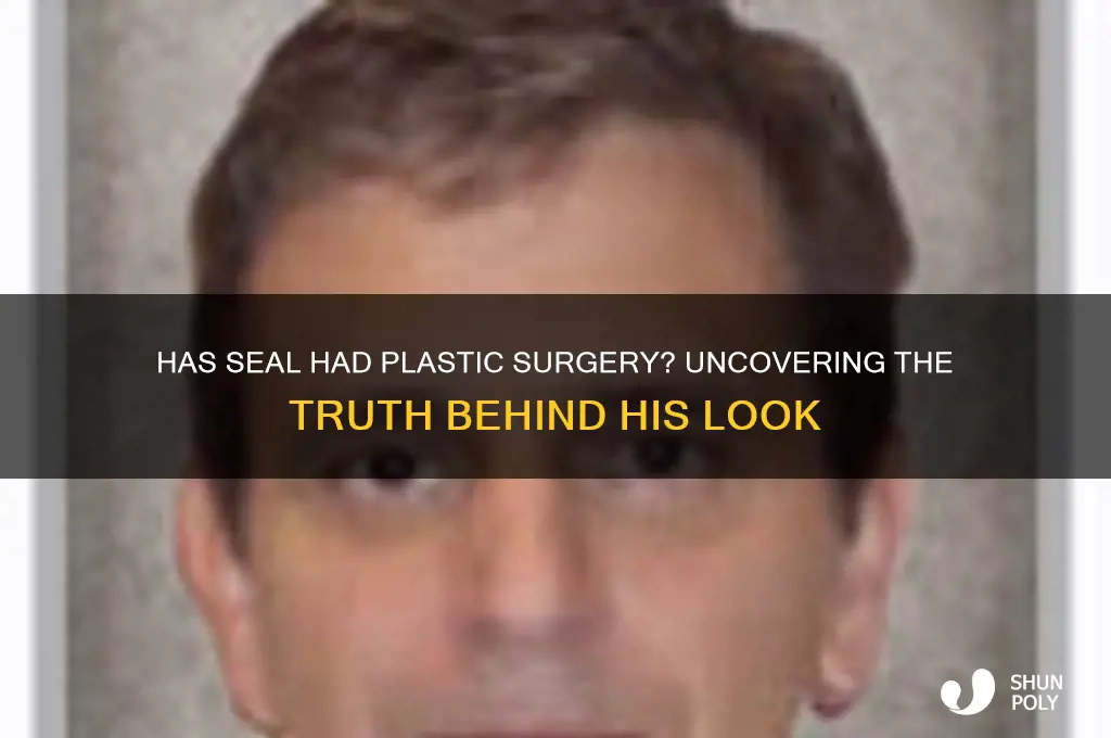 has seal had plastic surgery