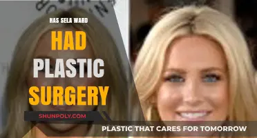 Sela Ward Plastic Surgery: Fact-Checking the Rumors and Speculations
