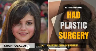 Selena Gomez Plastic Surgery: Fact-Checking the Rumors and Speculations