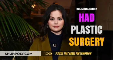 Selena Gomez Plastic Surgery: Fact-Checking the Rumors and Speculations