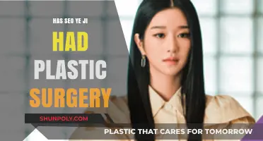 SEO Ye-ji Plastic Surgery: Fact-Checking the Rumors and Speculations