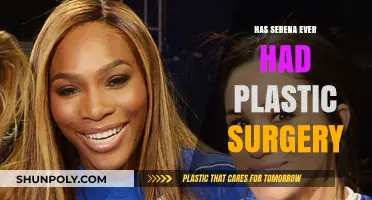 Serena Williams: Plastic Surgery Rumors and the Truth Behind Them