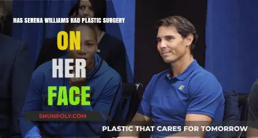 Serena Williams' Facial Transformation: Plastic Surgery Speculations Explored