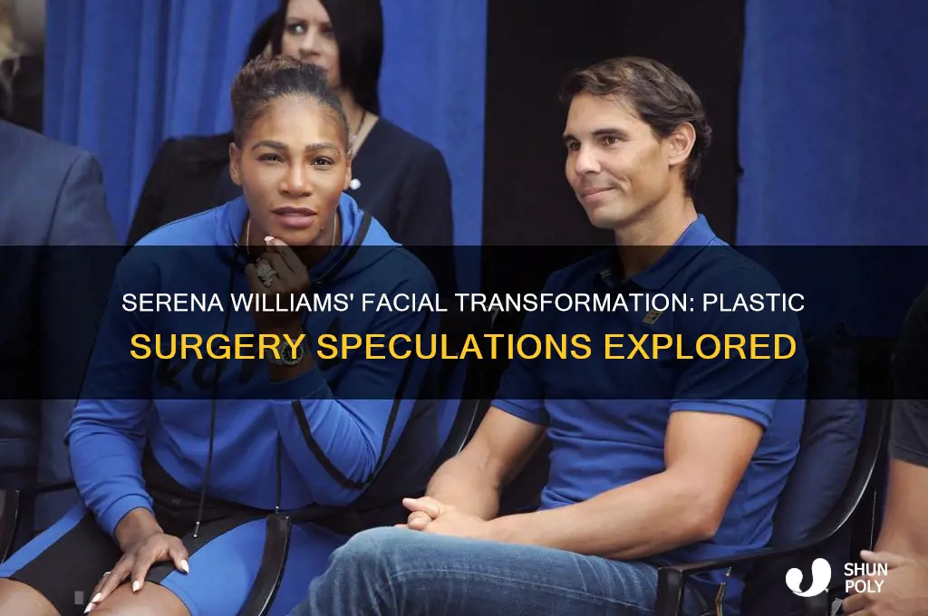 has serena williams had plastic surgery on her face