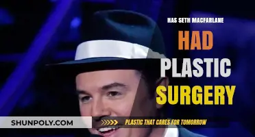 Seth MacFarlane Plastic Surgery: Fact-Checking the Transformation Rumors