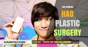 Seungri's Transformation: Unveiling the Truth About Plastic Surgery Rumors