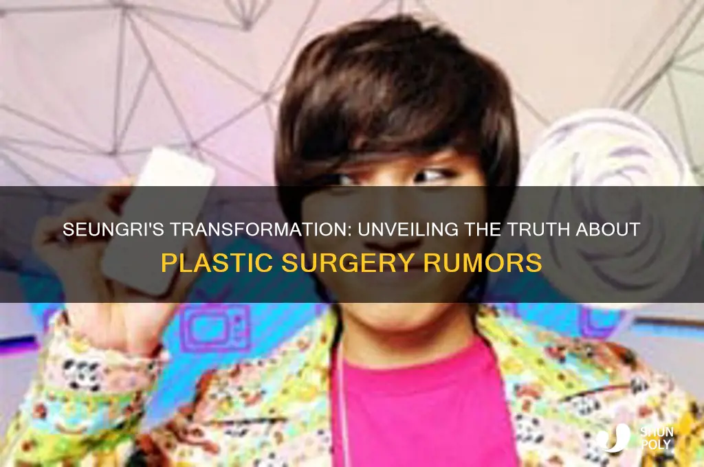 has seungri had plastic surgery