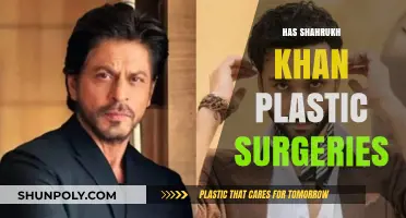 Shah Rukh Khan's Plastic Surgery Rumors: Fact or Fiction?