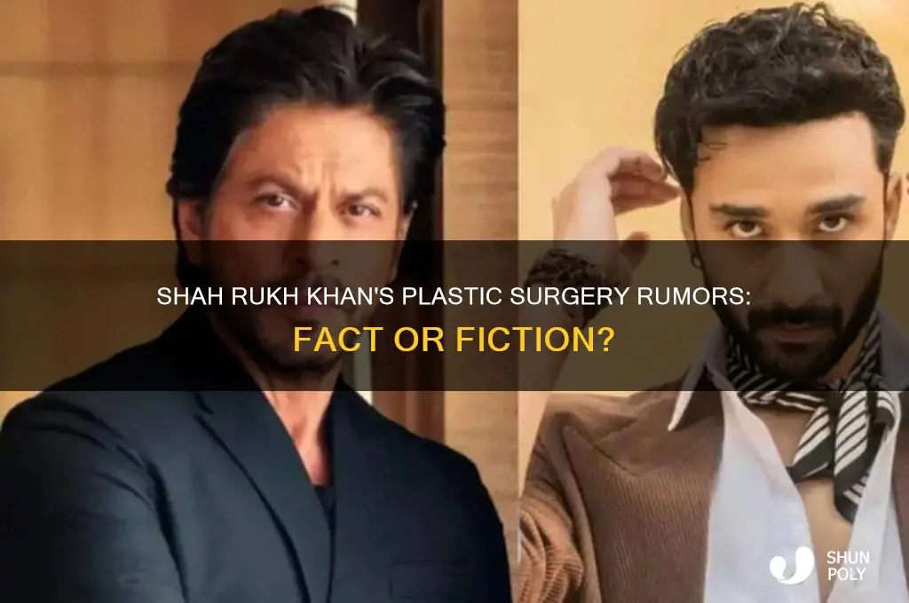 has shahrukh khan plastic surgeries