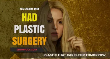 Shakira's Beauty Secrets: Plastic Surgery Rumors Explored and Debunked