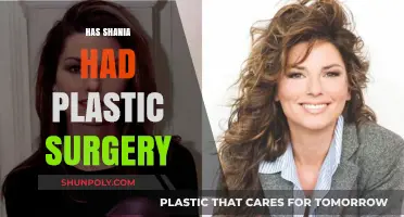Has Shania Twain Undergone Plastic Surgery? Unveiling the Truth