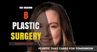 Shannon B's Transformation: Unveiling the Truth About Plastic Surgery