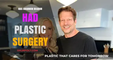Shannon Beador's Transformation: Plastic Surgery Rumors and Reality Revealed
