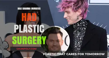Sharna Burgess Plastic Surgery: Fact-Checking the Rumors and Speculations