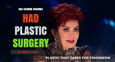Sharon Osbourne's Transformation: Plastic Surgery Rumors and Reality Revealed