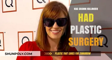 Shawn Killinger's Transformation: Plastic Surgery Rumors Explored and Debunked