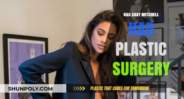 Shay Mitchell's Transformation: Plastic Surgery Rumors and Speculations