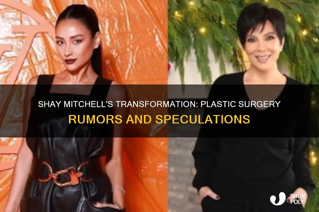 has shay mitchell had plastic surgery