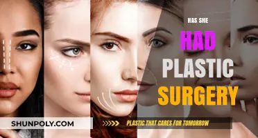 Has She Gone Under the Knife? Plastic Surgery Speculations Explored