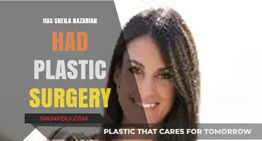 Has Sheila Nazarian Had Plastic Surgery? Unveiling the Truth