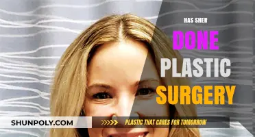 Has Sher Had Plastic Surgery? Unveiling the Truth Behind the Rumors