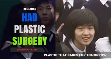 SHINee's Transformation: Plastic Surgery Speculations and Truths Revealed