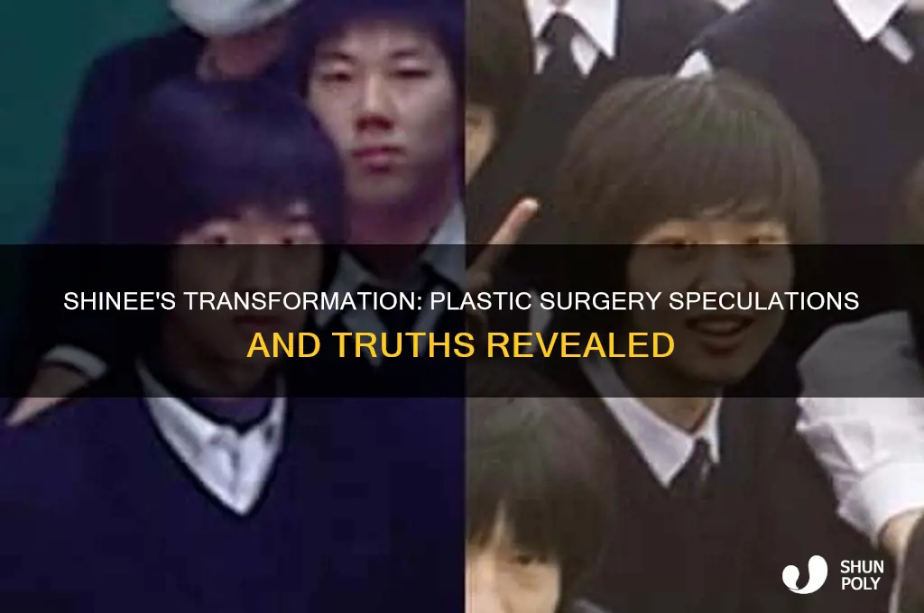 has shinee had plastic surgery