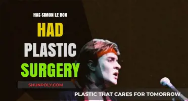 Simon Le Bon Plastic Surgery: Fact or Fiction?