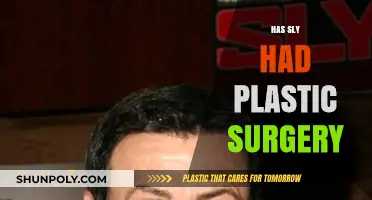 Has Sly Stallone Undergone Plastic Surgery? Unveiling the Truth