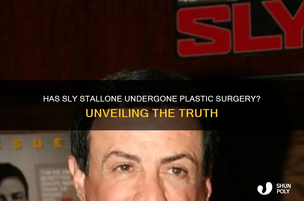 has sly had plastic surgery
