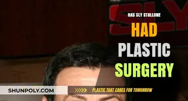 Sly Stallone's Transformation: Plastic Surgery Rumors and Reality Revealed