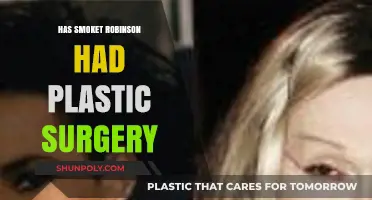 Has Smokey Robinson Had Plastic Surgery? Uncovering the Truth