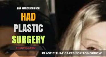 Smoky Robinson's Transformation: Plastic Surgery Rumors Explored
