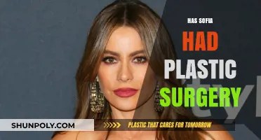 Sofia's Transformation: Plastic Surgery Rumors and the Truth Behind Them