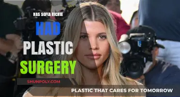 Sofia Richie's Transformation: Plastic Surgery Rumors and Reality Revealed