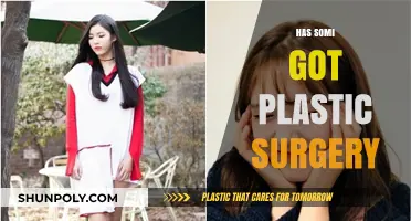 Has Somi Had Plastic Surgery? Uncovering the Truth Behind the Rumors