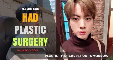 Song Kang Plastic Surgery: Fact-Checking the Rumors and Speculations