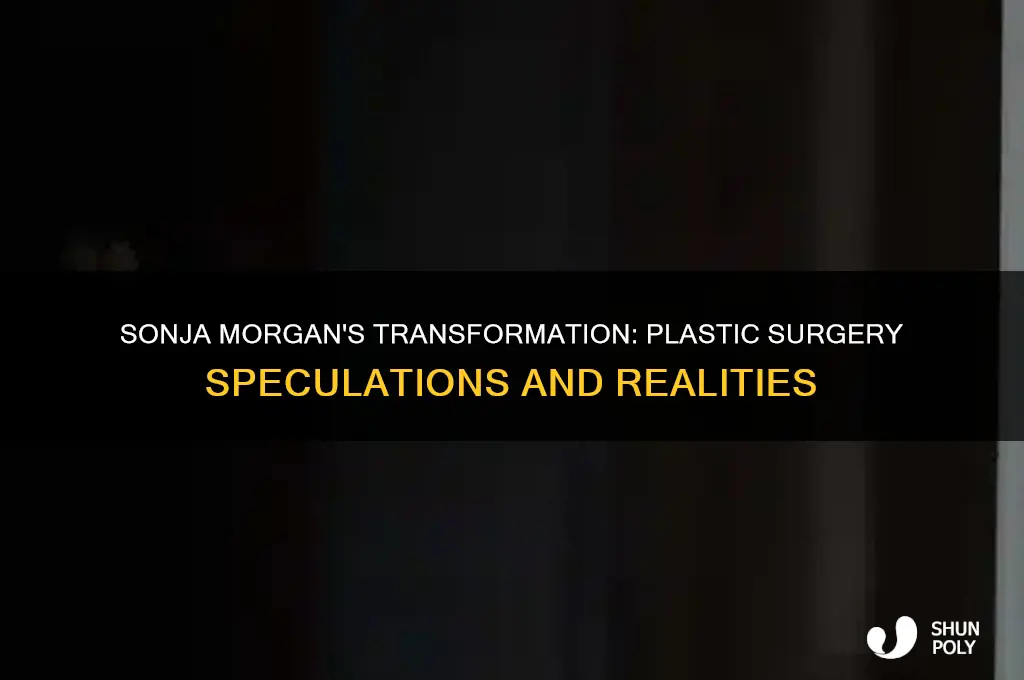 has sonja morgan had plastic surgery