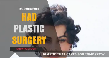 Has Sophia Loren Had Plastic Surgery? Unveiling the Truth