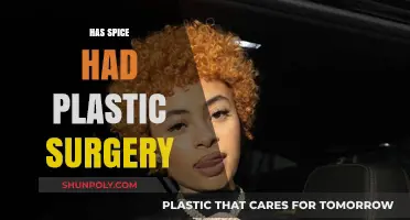 Spice's Transformation: Plastic Surgery Rumors and the Truth Behind Her Look