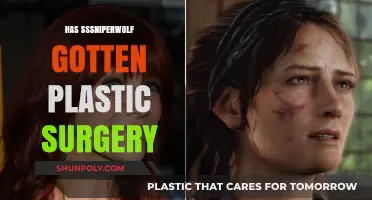 Has SSSniperWolf Had Plastic Surgery? Uncovering the Truth