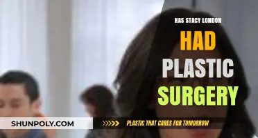 Stacy London's Transformation: Plastic Surgery Speculations and Truths Revealed