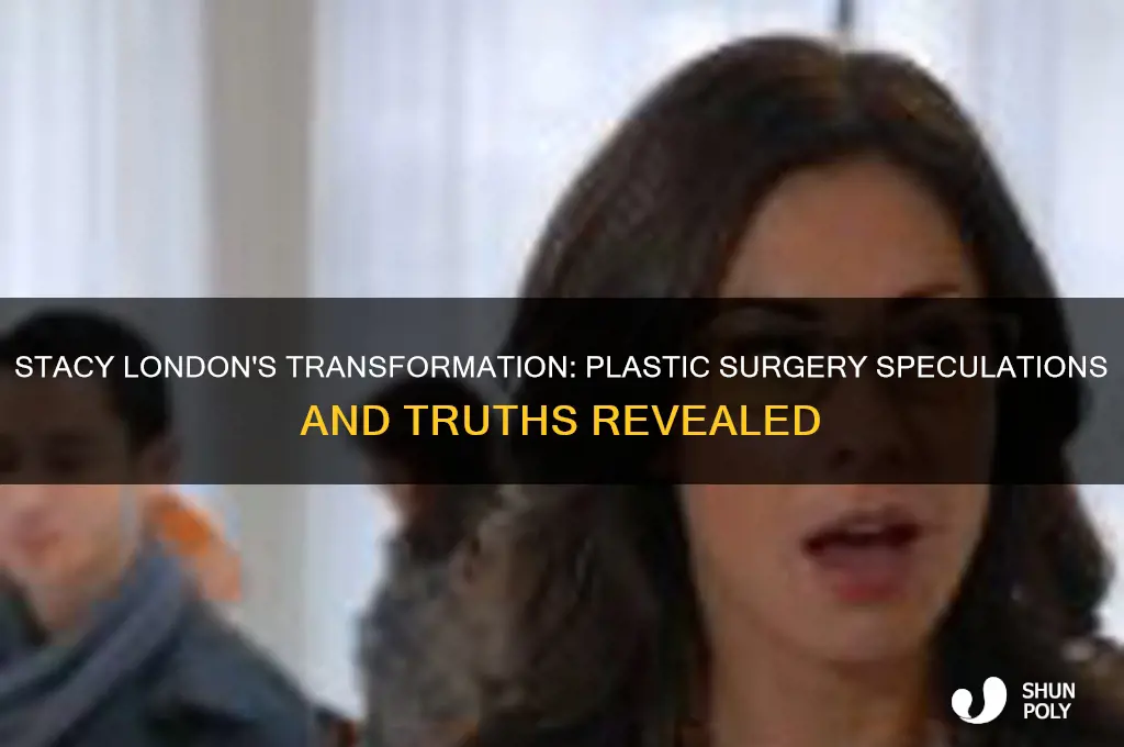 has stacy london had plastic surgery
