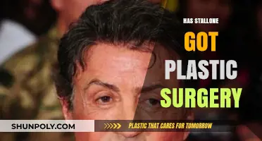 Has Sylvester Stallone Undergone Plastic Surgery? The Truth Revealed