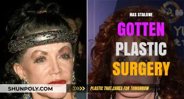 Has Stallone Had Plastic Surgery? Examining the Rumors and Evidence
