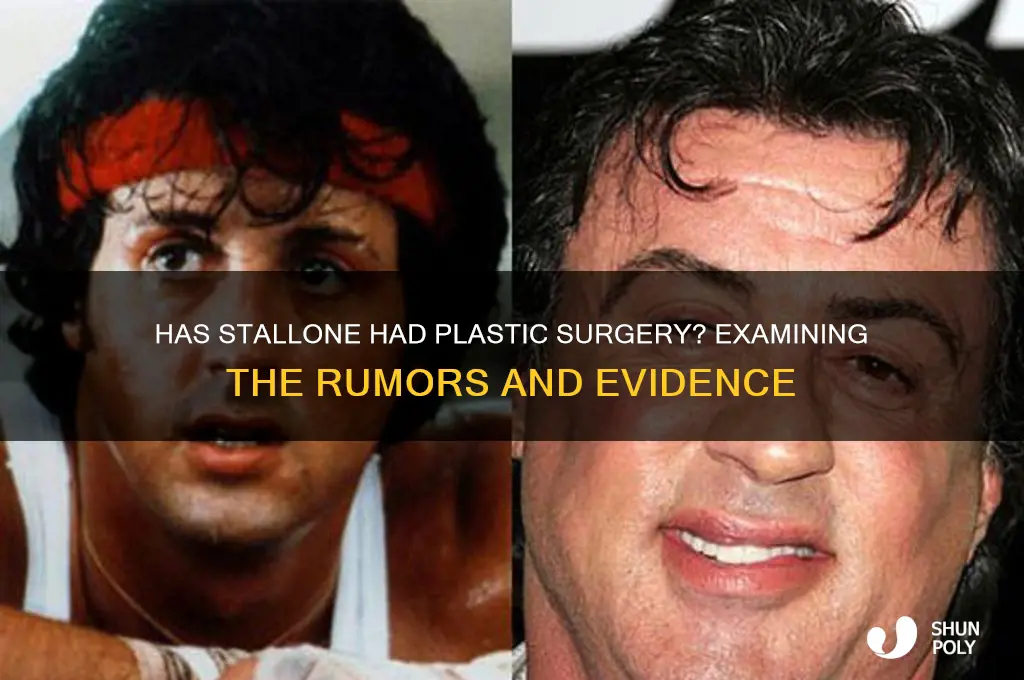 has stalone gotten plastic surgery