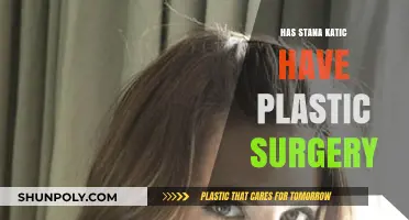 Stana Katic Plastic Surgery: Fact-Checking the Rumors and Speculations