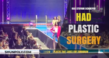 Stefani Schaefer Plastic Surgery: Fact-Checking the Rumors and Speculations